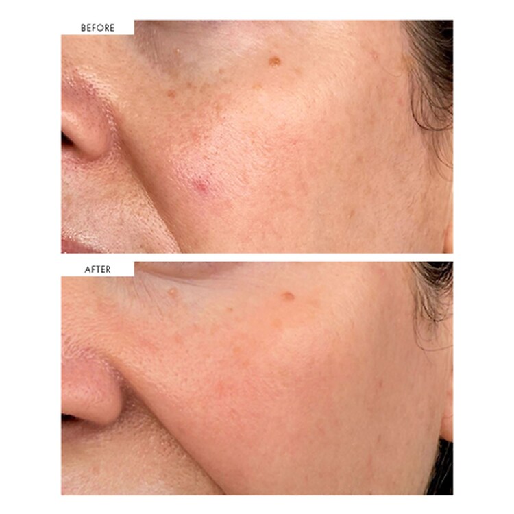 DARK SPOT CORRECTING SERUM - SÉRUM CORRECTEUR DE TACHES SOMBRES