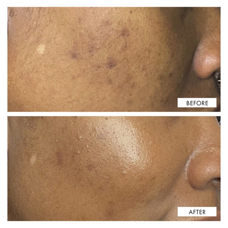 DARK SPOT CORRECTING SERUM - SÉRUM CORRECTEUR DE TACHES SOMBRES