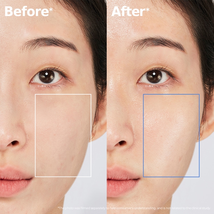 ATOBARRIER365 Crème - Crema idratante e rinforzante per la barriera cutanea