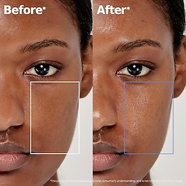 ATOBARRIER365 Lotion - Loci&oacute;n para hidratar y reforzar la barrera cut&aacute;nea