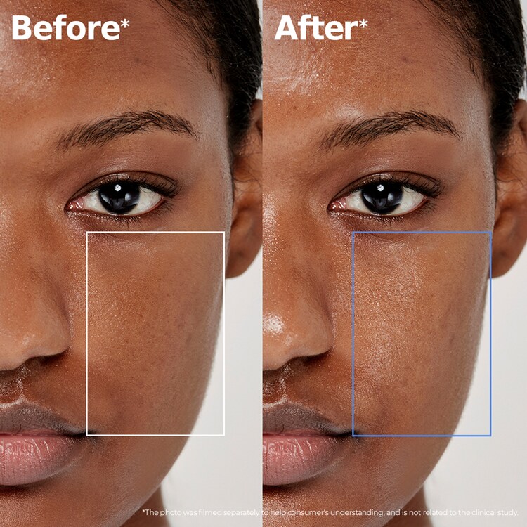 ATOBARRIER365 Lotion - Lotion pour hydrater & renforcer la barrière cutanée