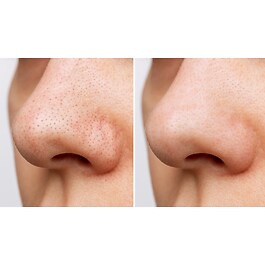 Heartleaf Pore Control Cleansing Oil - Olio detergente struccante