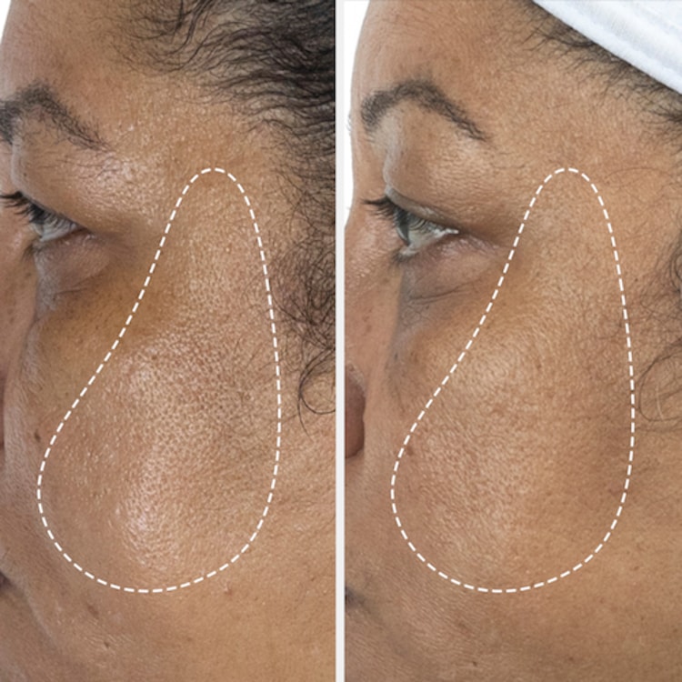 The Serum Nomad - Le Sérum Nomad