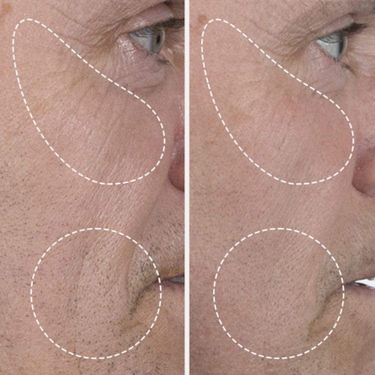 The Serum Nomad - Le Sérum Nomad