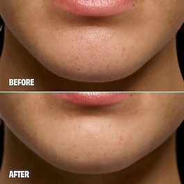 The POREfessional Degunker - produkt na či&scaron;těn&iacute; p&oacute;rů a čern&yacute;ch teček