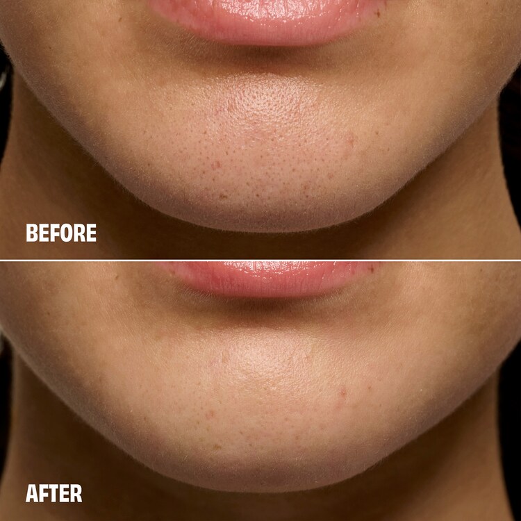 The POREfessional Degunker - Maschera viso per pulizia pori e punti neri