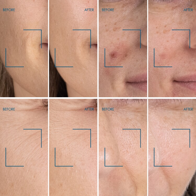 Blue Retinol Night Serum - Serum antirid