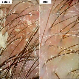 Scalp Revival - Shampooing micro-exfoliant charbon et huile de coco