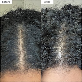 Scalp Revival - Shampooing micro-exfoliant charbon et huile de coco