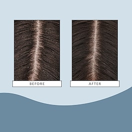 Scalp Revival - Masque Hydratant et rafraîchissant pour le cuir chevelu