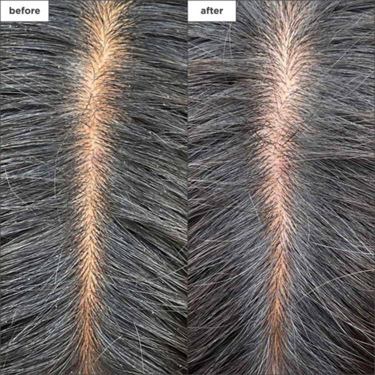 Scalp Revival - Masque Hydratant et rafraîchissant pour le cuir chevelu