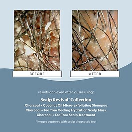 Scalp Revival Charcoal - Arındırıcı Şampuan