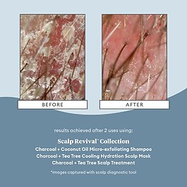 Scalp Revival Charcoal - Arındırıcı Şampuan