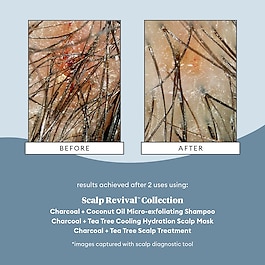 Scalp Revival Charcoal - Kuracja do skóry głowy