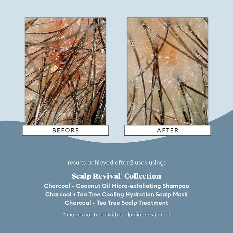 Scalp Revival Charcoal - Tratamiento para el cuero cabelludo 