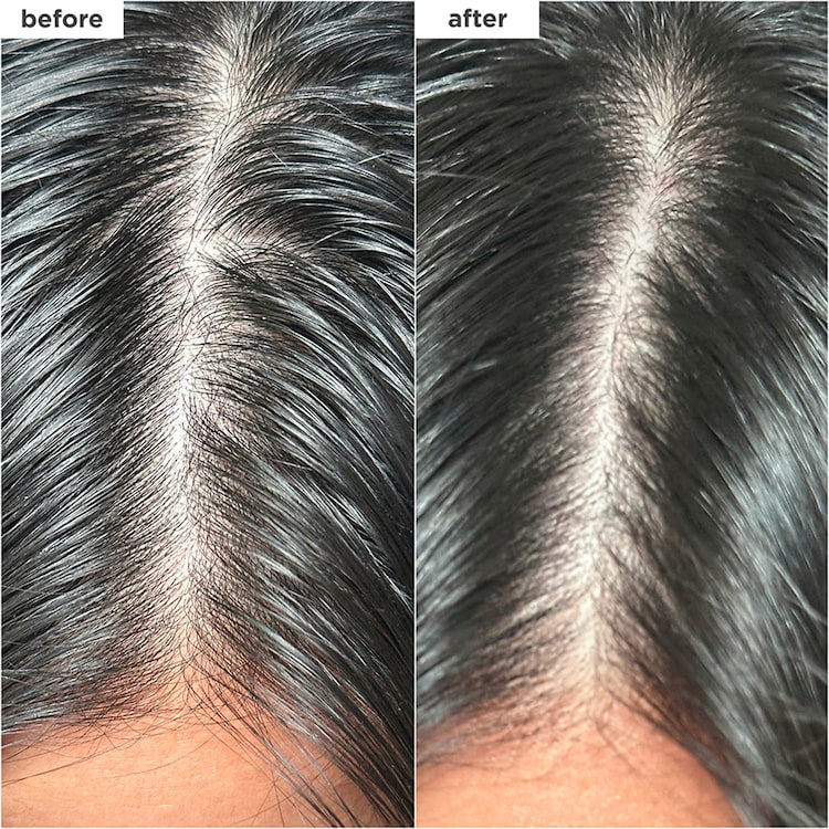 Scalp Revival Charcoal + Biotin Dry Shampoo