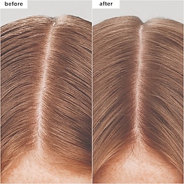 Scalp Revival™ - Charcoal + Biotin Dry Shampoo