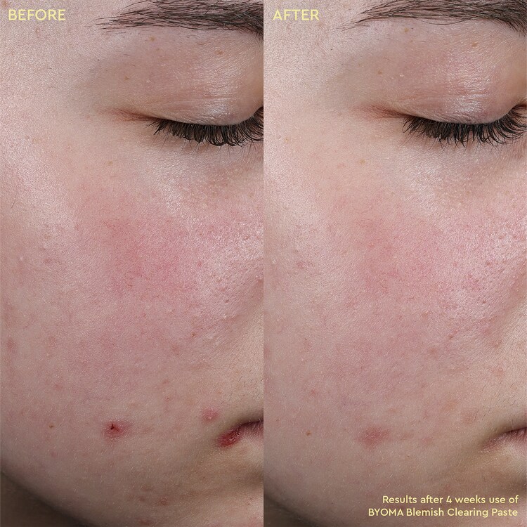 Blemish Clearing Paste - Pasta anti-imperfezioni