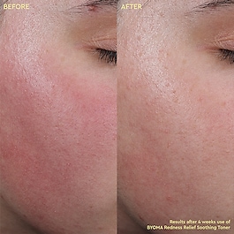 Redness Relief Soothing Toner - Tonico lenitivo antiarrossamento