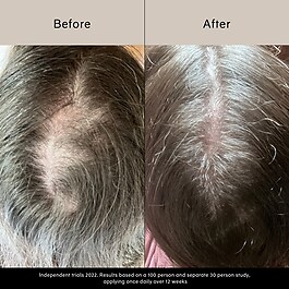 Pitta Growth Serum - Siero di crescita