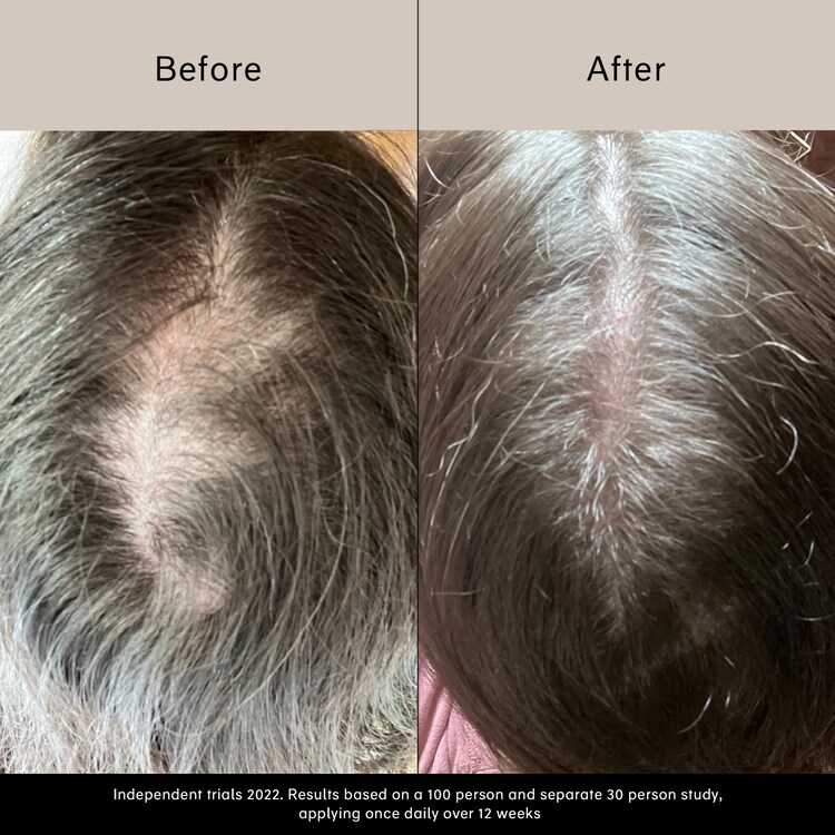 Pitta Growth Serum - Sérum de croissance pour cheveux