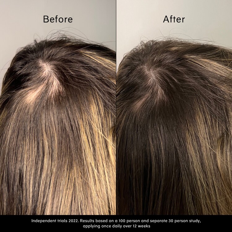 Pitta Growth Serum - Sérum de croissance pour cheveux