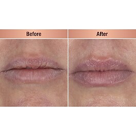 Life Changing Lip Mask - Maschera notte per le labbra