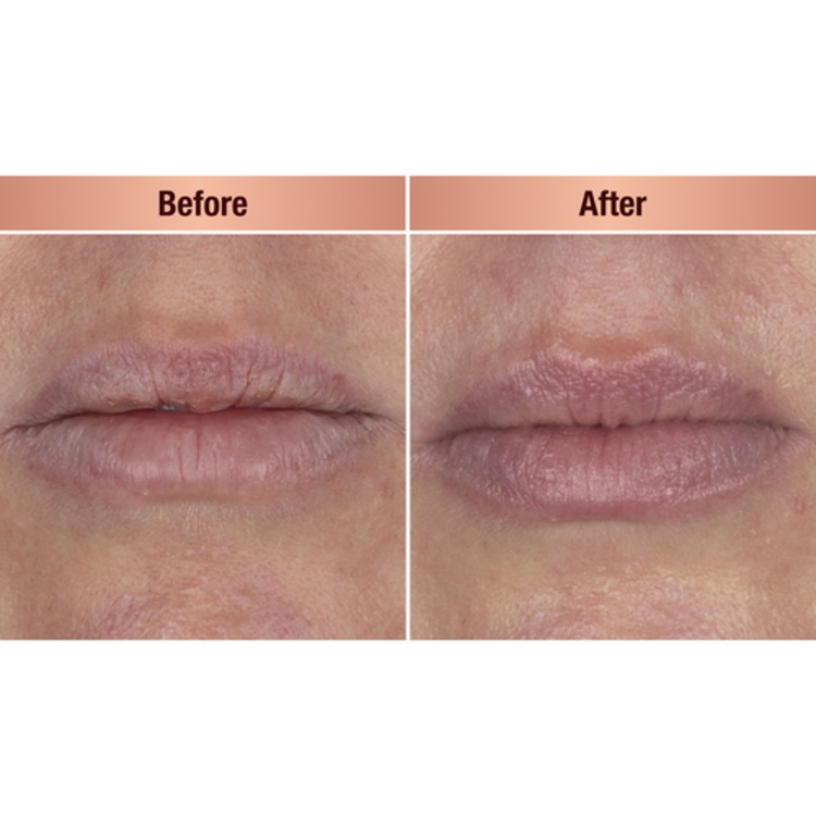 Life Changing Lip Mask - Masque de nuit pour les lèvres