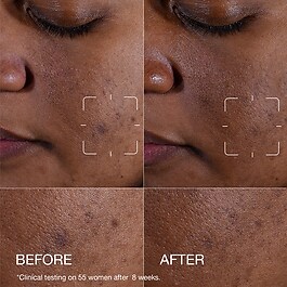 Even Better Clinical™ Dark Spot Clearing Serum - Serum korygujące przebarwienia