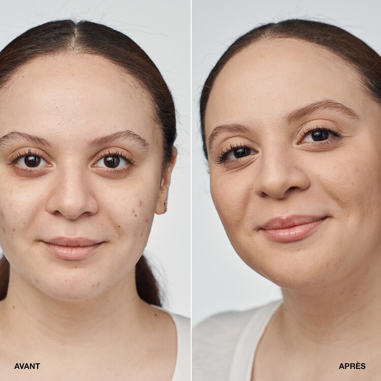 Even better Clinical - Serum Foundation SPF 20