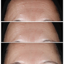 Smart Clinical Repair™ - Wrinkle Correcting Serum