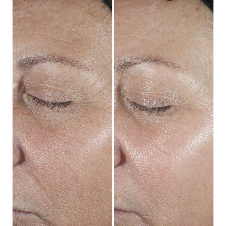 Clinique Smart Clinical Repair™  Sérum - Corrector de Arrugas 