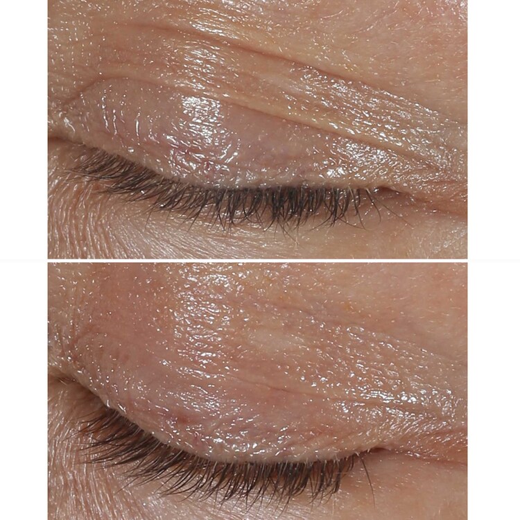 Smart Clinical Repair Wrinkle Correcting Eye Cream