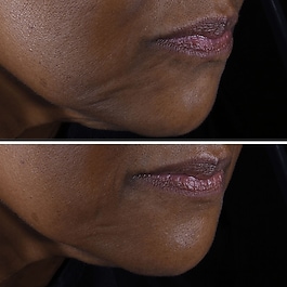 Smart Clinical Repair - Lifting Face + Neck Cream