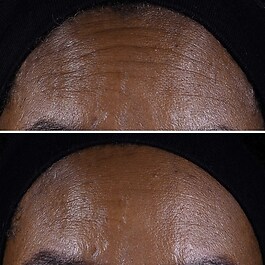 Smart Clinical Repair - Lifting Face + Neck Cream