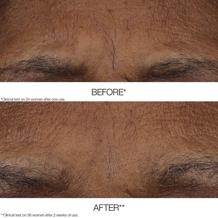 Smart Clinical Repair™ - Baume Rétinoïde Anti-rides Matin/Soir