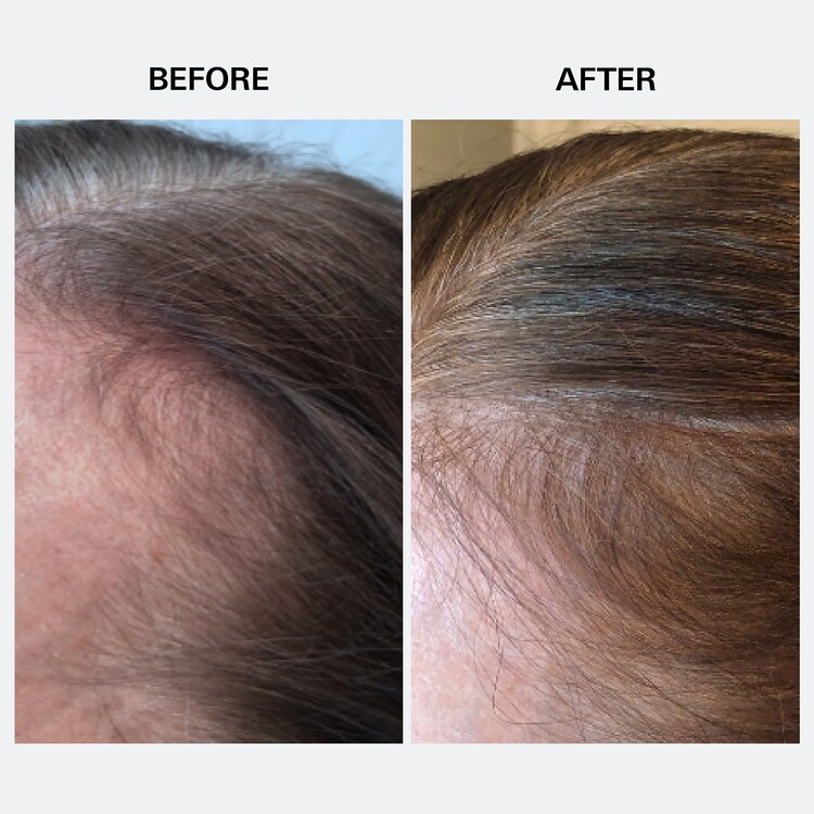 Youth Juice - Soin du cuir chevelu au collagène