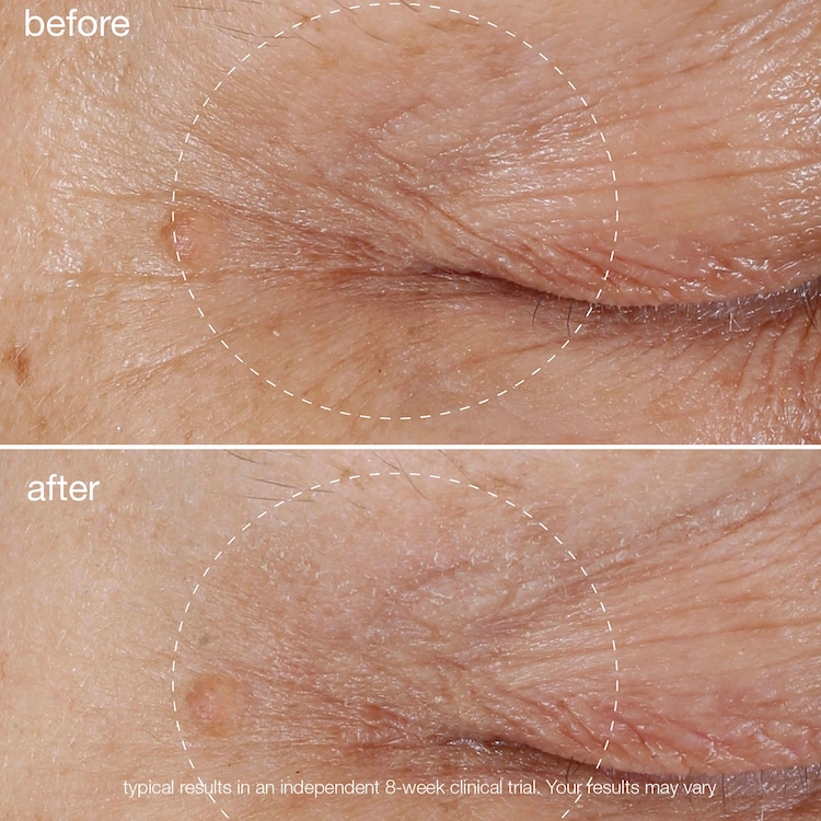 Biolumin-C Eye Serum - Vitamin C Radiance Booster