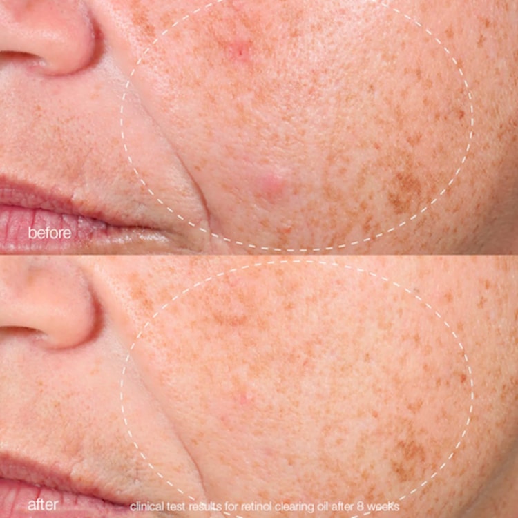 Retinol Clearing Oil - Huile Purifiante au Rétinol