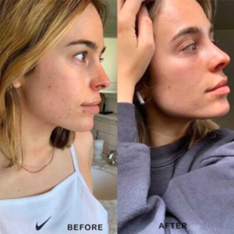 Retinol Clearing Oil - Huile Purifiante au Rétinol