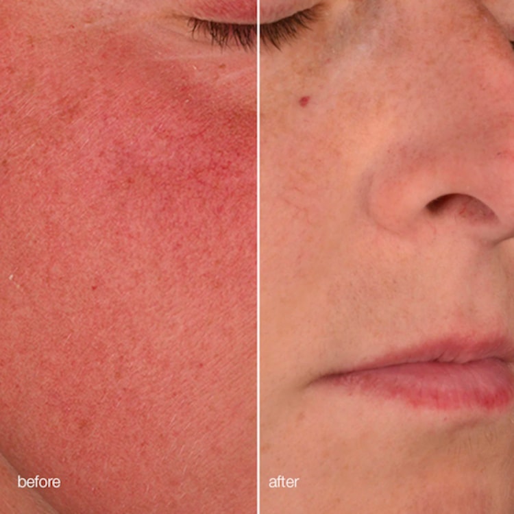 Retinol Clearing Oil - Huile Purifiante au Rétinol