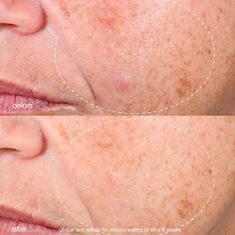 Retinol Clearing Oil - Pflegeöl für die Nacht