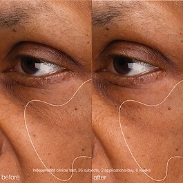 Biolumin-C Gel - Crema gel hidratanta