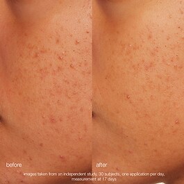 Daily Microfoliant Exfoliator