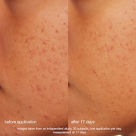 Daily Microfoliant - Mildes enzymatisches und mechanisches Peeling