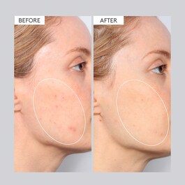 T.L.C. Sukari Babyfacial&trade; - Soin Lissant Visage