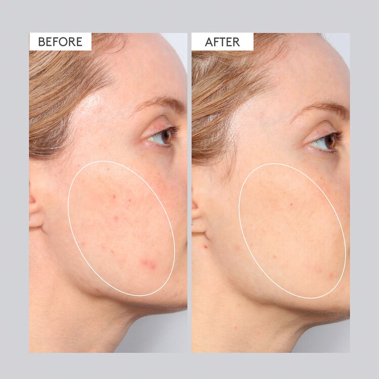 T.L.C. Sukari Babyfacial™ - Dybderensende Ansigtsmaske