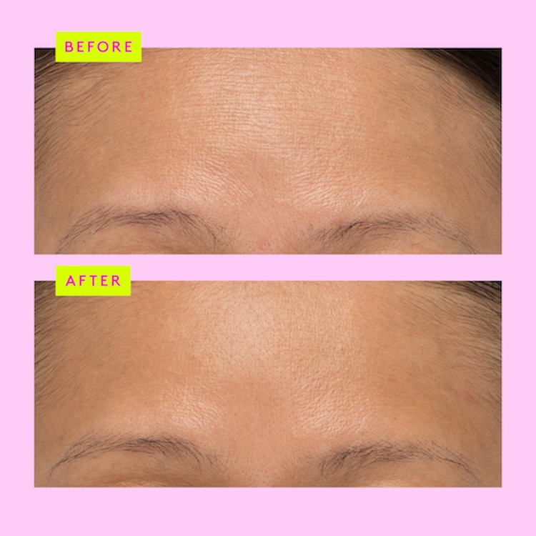 T.L.C. Framboos™ - Sérum de Nuit Glycolique