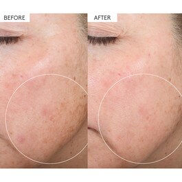 C-Firma&trade; Fresh - S&eacute;rum de Jour Vitamine C