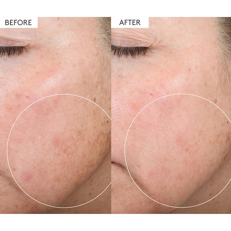 C-Firma™ Fresh Day - Serum